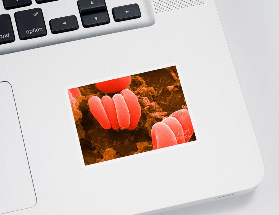 Biology Sticker featuring the photograph Red Blood Cells, Rouleaux Formation, Sem by Science Source