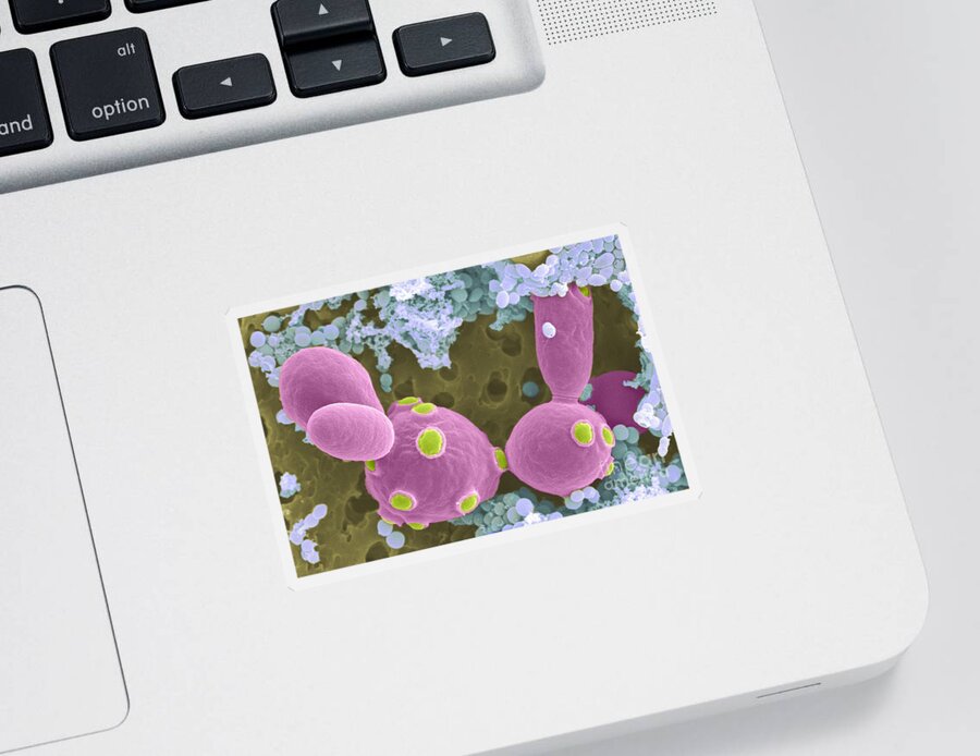 Saccharomyces Cerevisiae Sticker featuring the photograph Saccharomyces Cerevisiae Sem #1 by Scimat