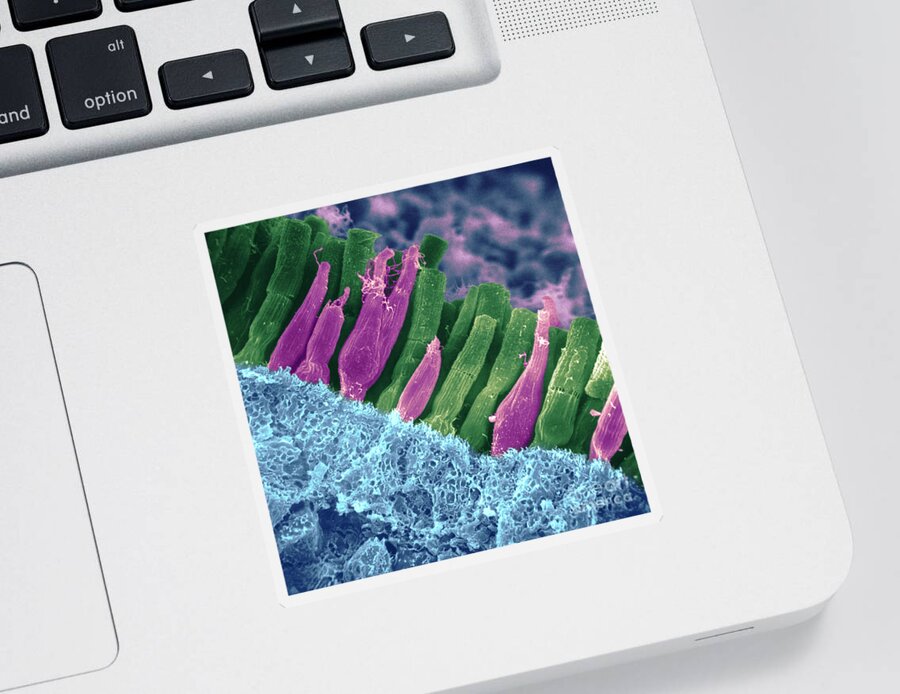 Scanning Electron Micrograph Sticker featuring the photograph Rods And Cones In Retina by Omikron