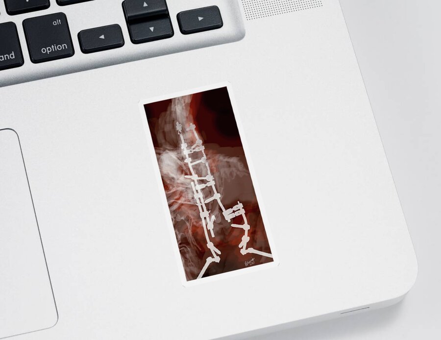 #spinalprosthesis Sticker featuring the digital art Spinal Prosthesis, Study 7 by Veronica Huacuja