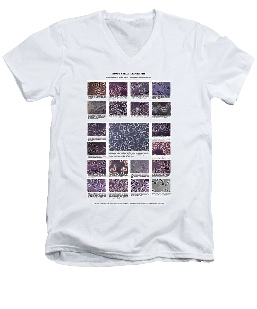 Blood Men's V-Neck T-Shirt featuring the photograph Blood morphology by Hugh Smith