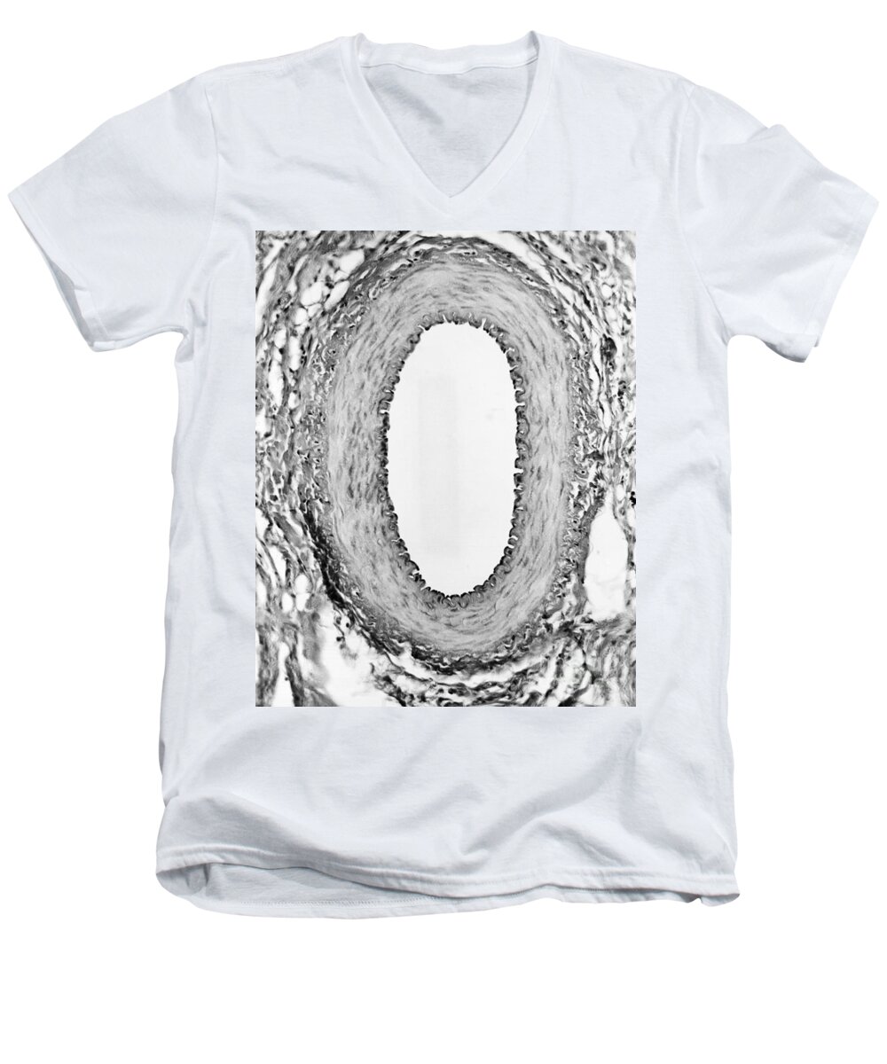 Science Men's V-Neck T-Shirt featuring the photograph Normal Artery, Tem by Omikron