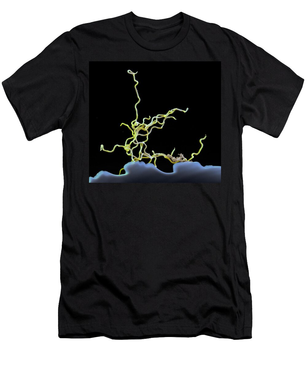 Lyme Disease T-Shirt featuring the photograph Borrelia Kurtenbachii, Sem #3 by Eye of Science