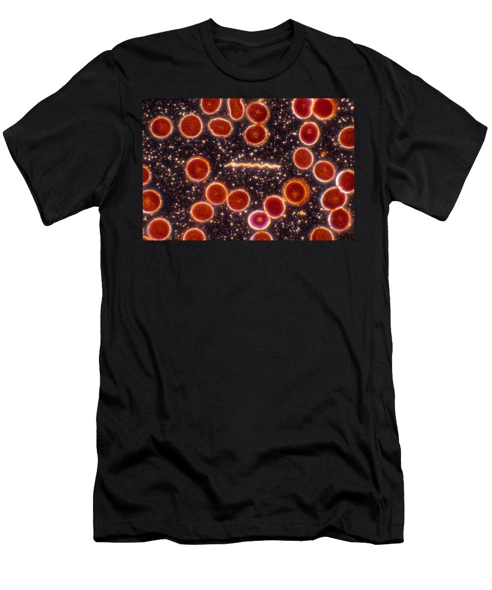 Bacteria T-Shirt featuring the photograph Borrelia Burgdorferi, Lm by Michael Abbey
