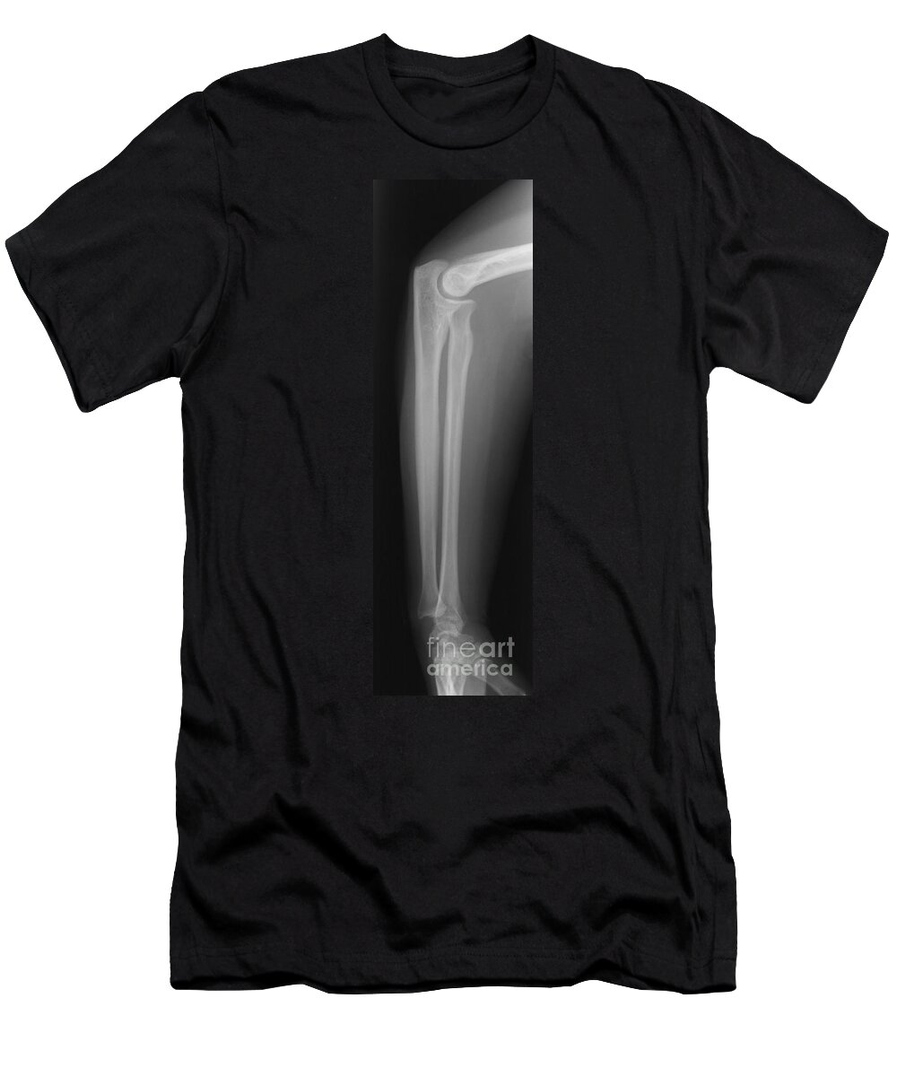 Skeleton T-Shirt featuring the photograph Arm #1 by Ted Kinsman
