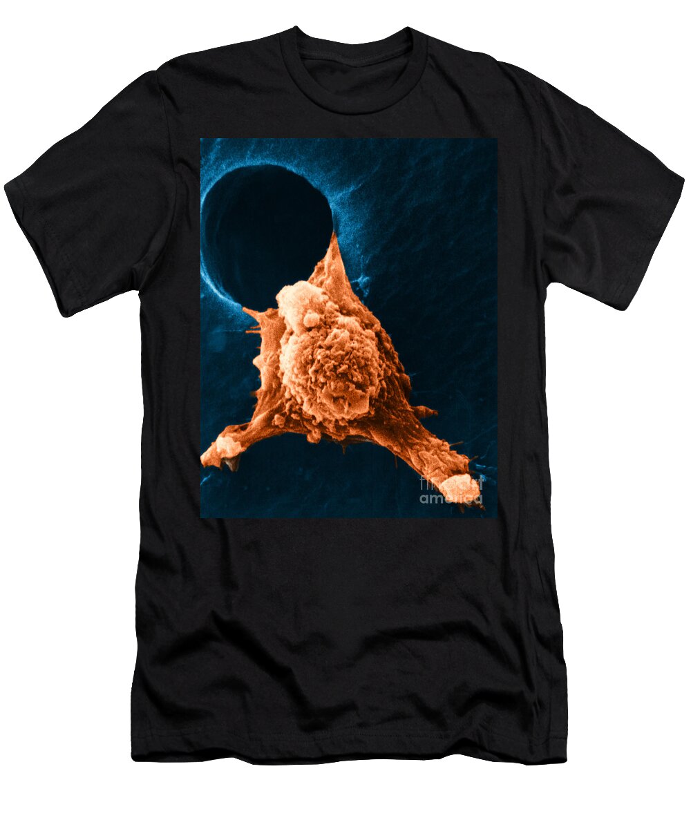 Sem T-Shirt featuring the photograph Metastasis #3 by Science Source
