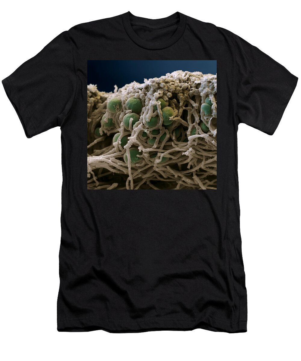 Algae T-Shirt featuring the photograph Hammered Shield Lichen by Oliver Meckes EYE OF SCIENCE