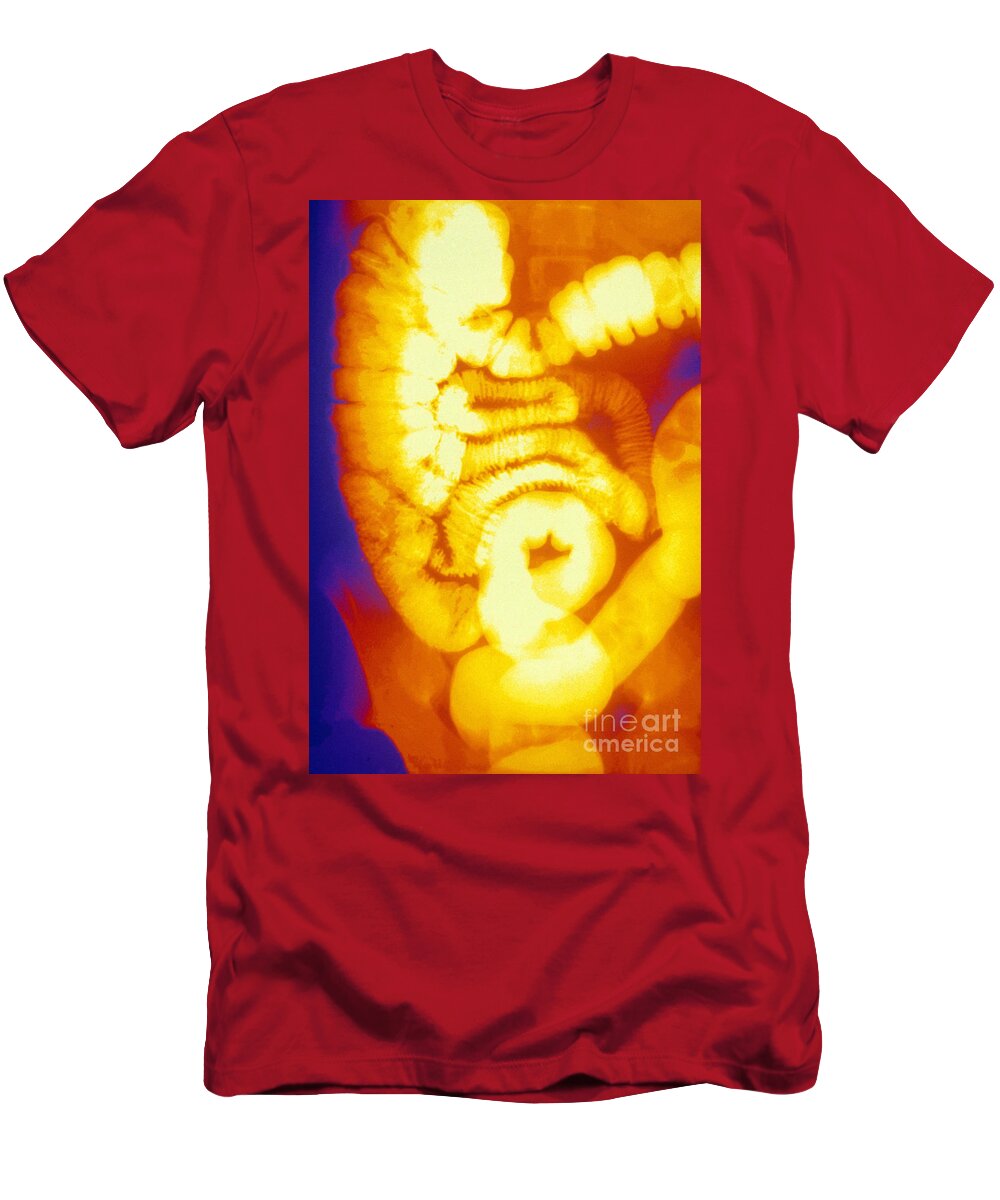 Medical T-Shirt featuring the photograph Large And Small Intestine, Barium X-ray #2 by Susan Leavines