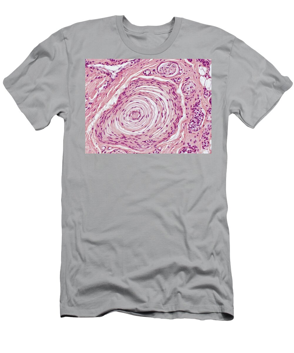 Pacinian Corpuscle T-Shirt featuring the photograph Pacinian Corpuscle Lm by Alvin Telser