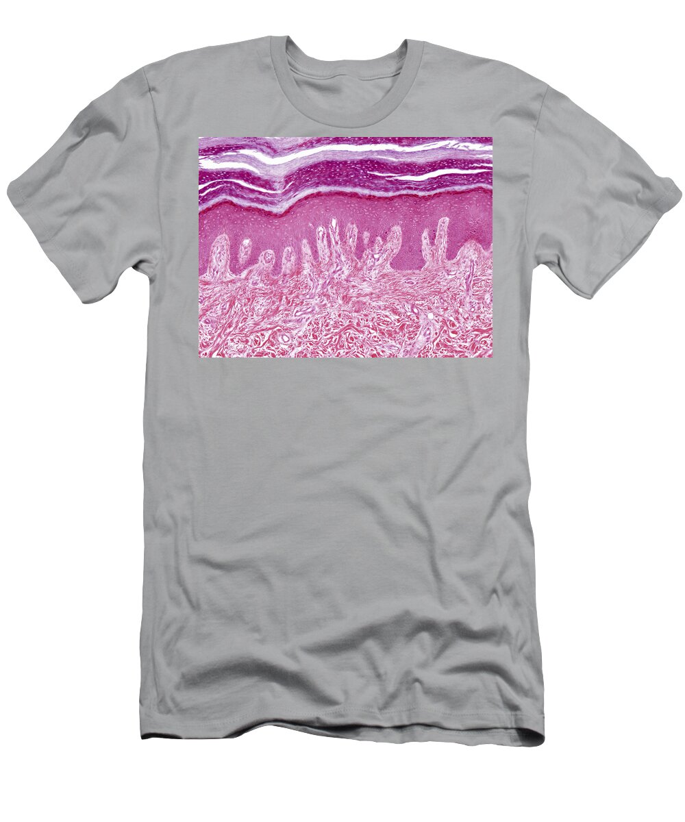 Skin T-Shirt featuring the photograph Plantar Skin, Lm by Alvin Telser
