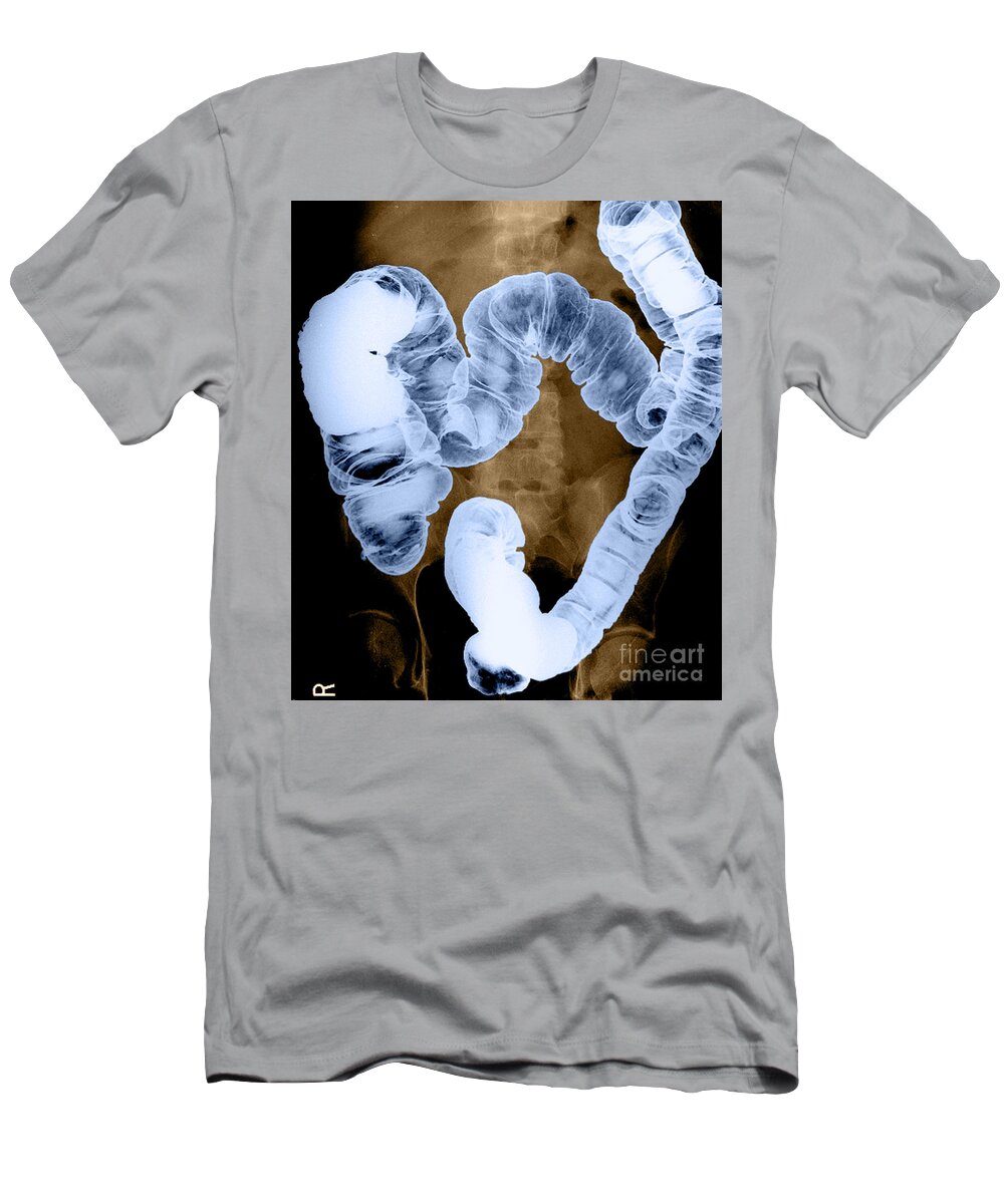 Intestine T-Shirt featuring the photograph Normal Double Contrast Barium Enema #11 by Medical Body Scans