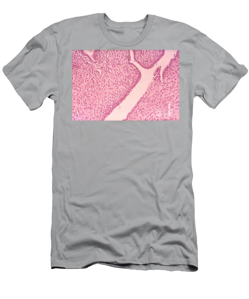 Science T-Shirt featuring the photograph Decidual Cells Lm by M. I. Walker