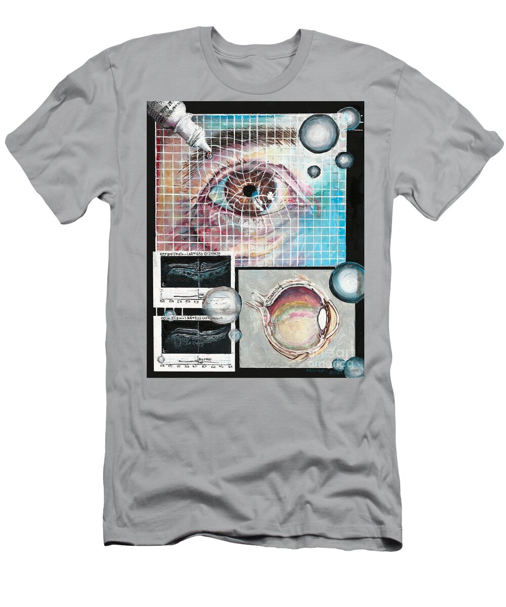 Eye T-Shirt featuring the painting Macular Hole Repair by Merana Cadorette