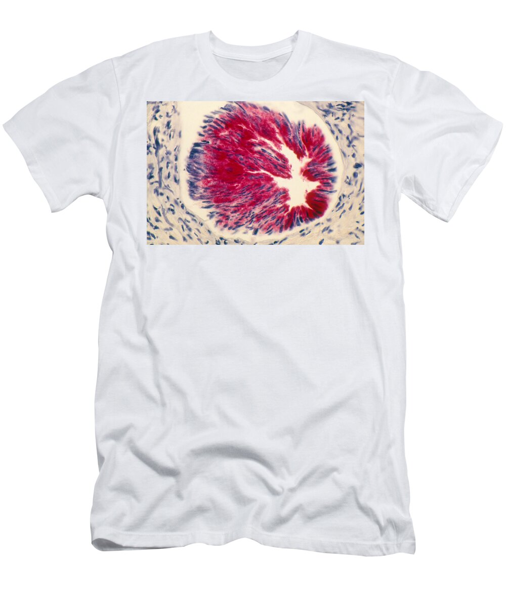 Anatomy T-Shirt featuring the photograph Human Prostate, Lm by Michael Abbey