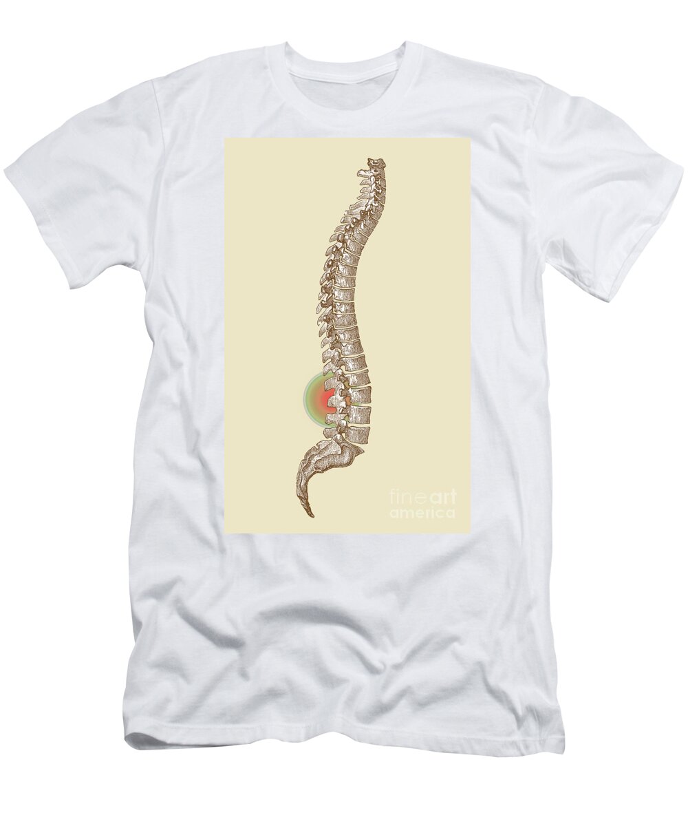 Ache T-Shirt featuring the photograph Lower Back Pain #1 by Science Source