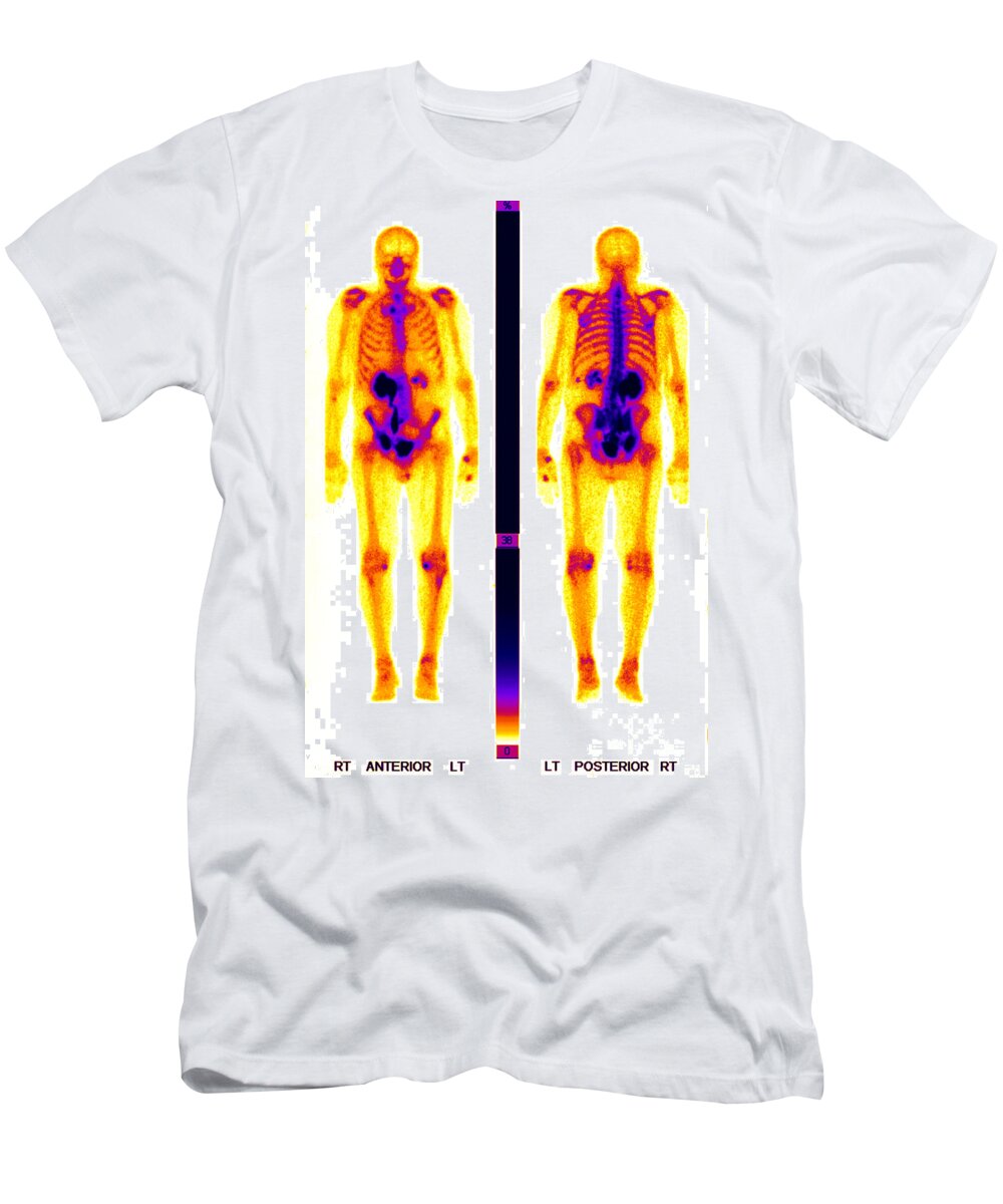 Biology T-Shirt featuring the photograph Nuclear Medicine #2 by Ted Kinsman