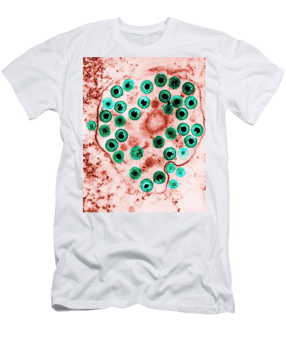 Disease T-Shirt featuring the photograph Herpes #3 by Science Source