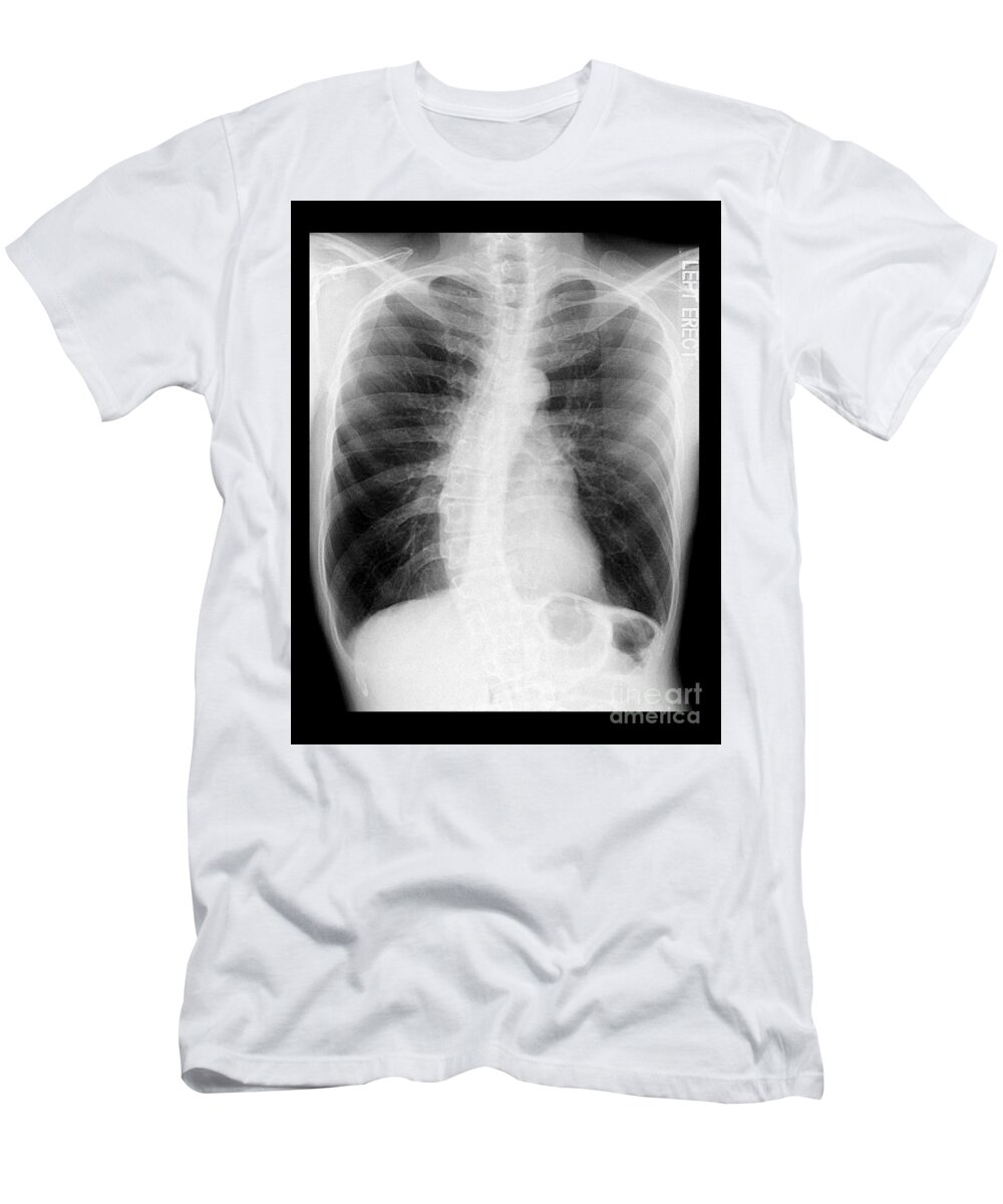 t shirt x ray