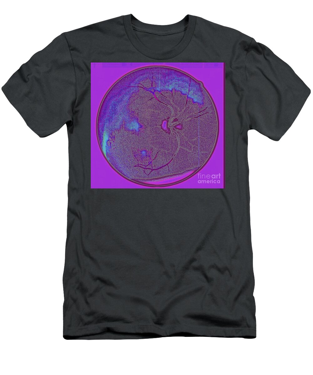 Eye T-Shirt featuring the photograph Digital Art - Retinal Imaging by Mars Besso