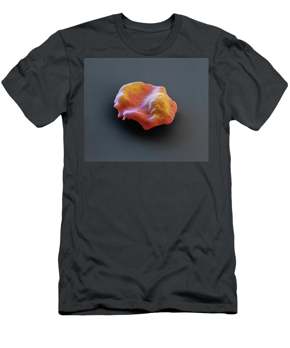 Disease T-Shirt featuring the photograph Malaria-infected Blood, Sem #6 by Eye Of Science