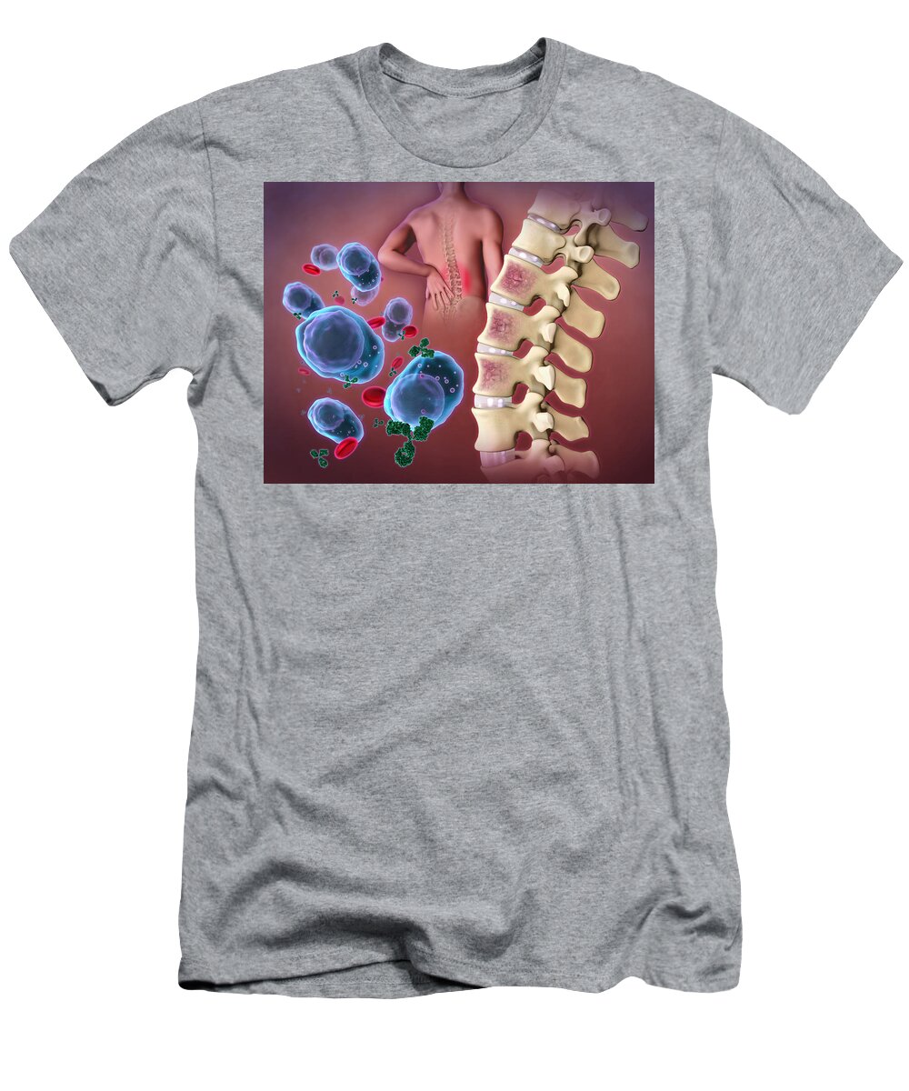 Science T-Shirt featuring the photograph Multiple Myeloma by Evan Oto
