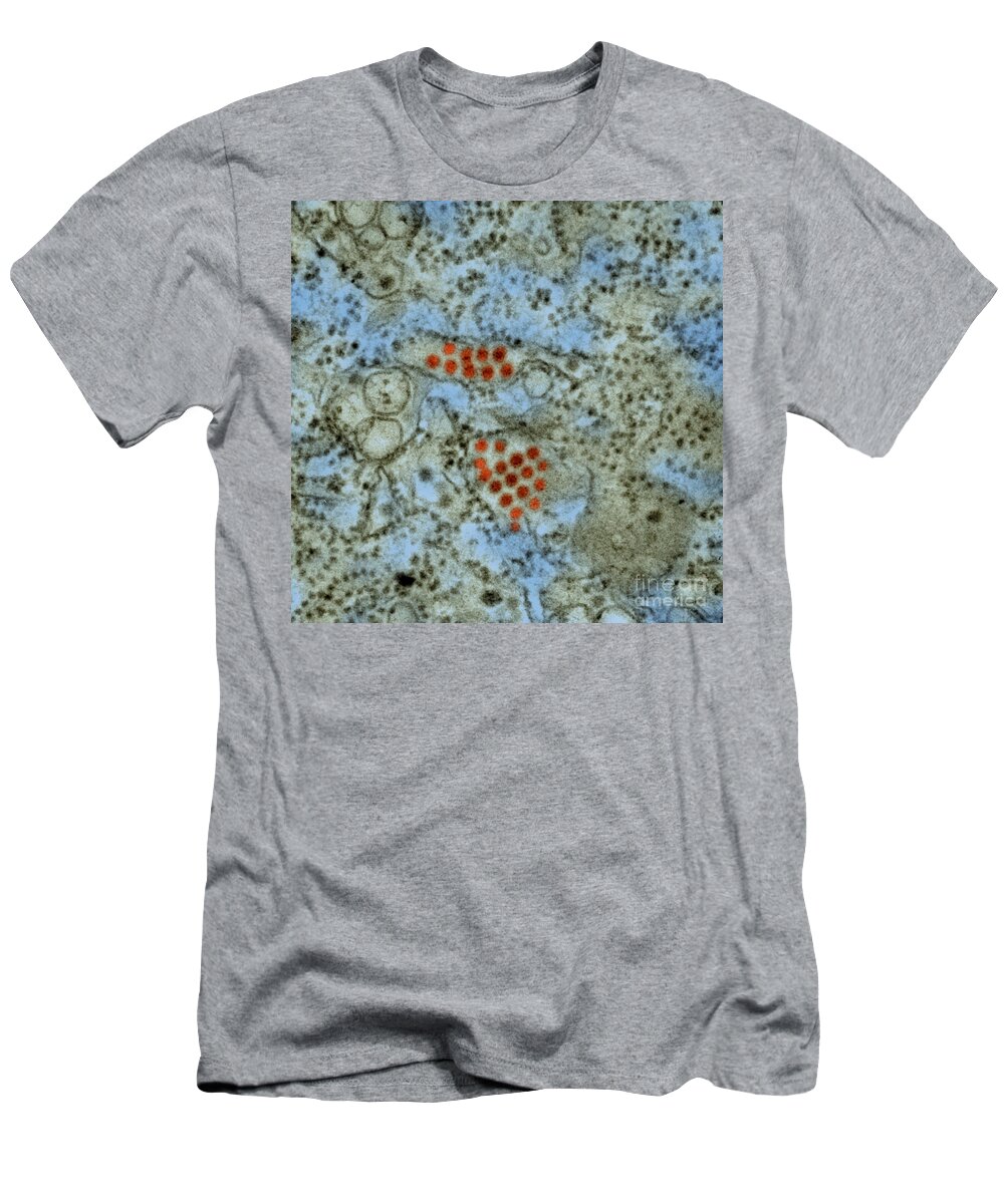 Dengue T-Shirt featuring the photograph Dengue Virus Tem #3 by Science Source