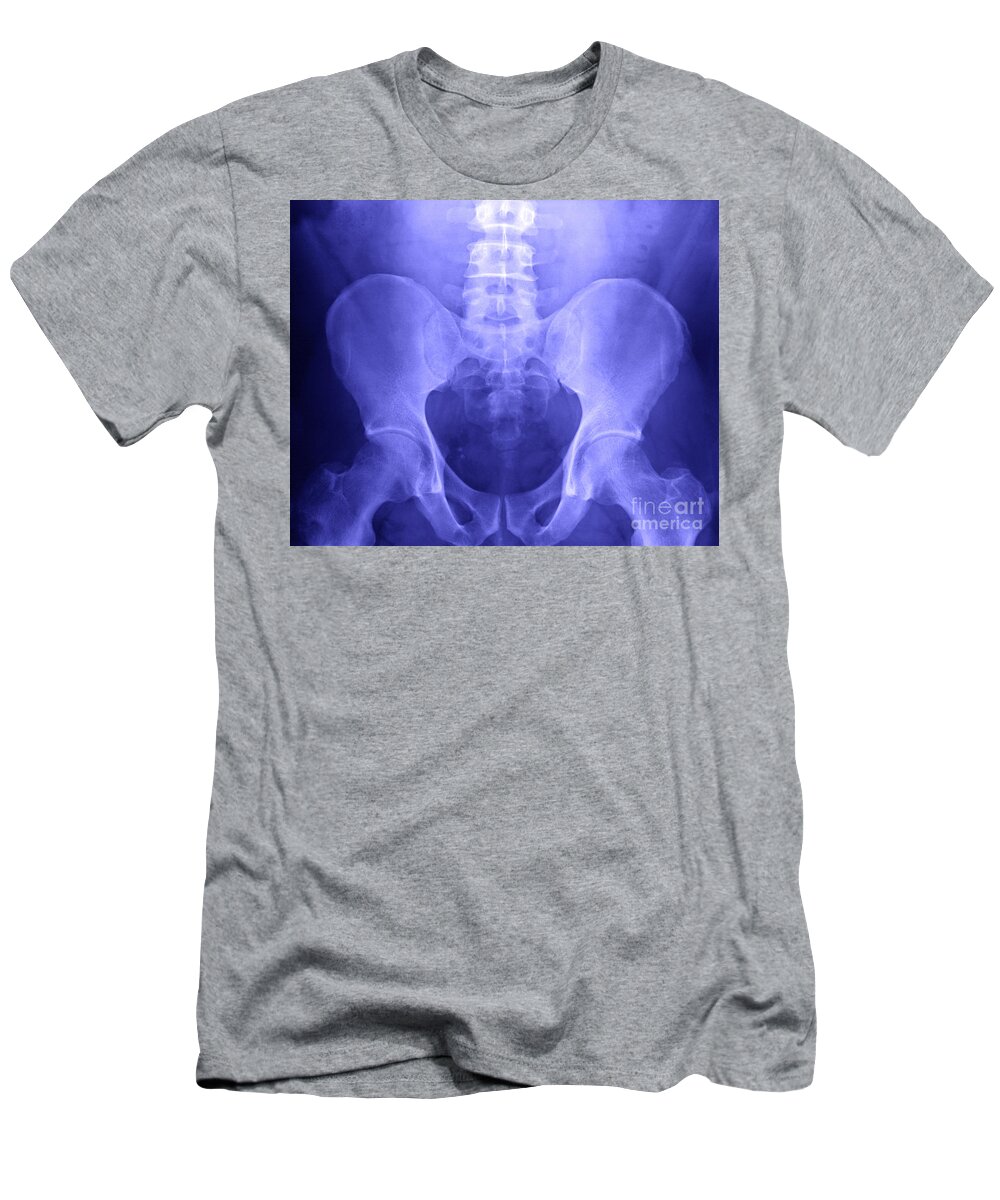 Xray T-Shirt featuring the photograph Pelvic X-ray by Ted Kinsman