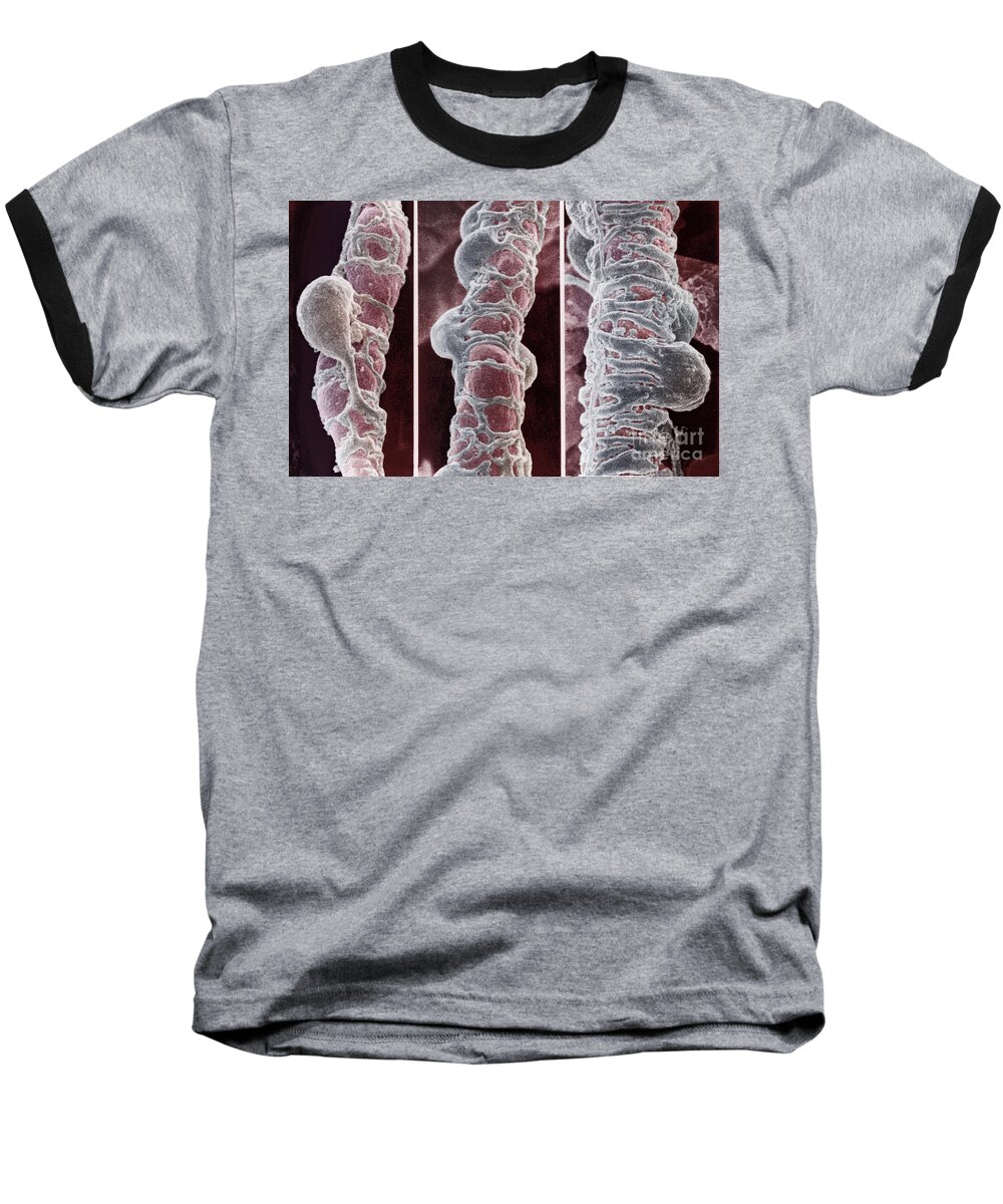 Blood Baseball T-Shirt featuring the photograph Pericytes by Science Source