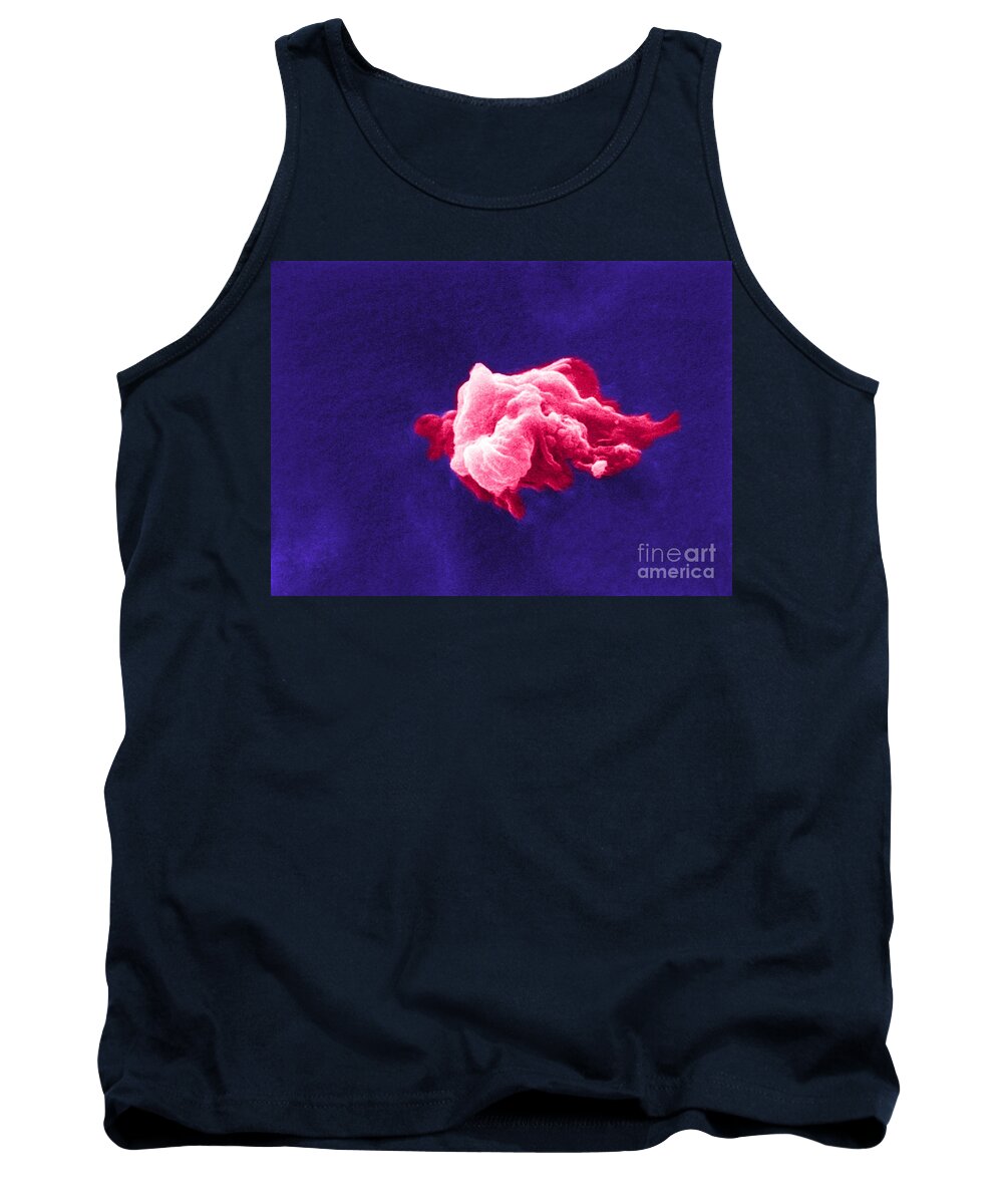 Scanning Electron Micrograph Tank Top featuring the photograph Cancer Cell Death, Sem 6 Of 6 #1 by Science Source