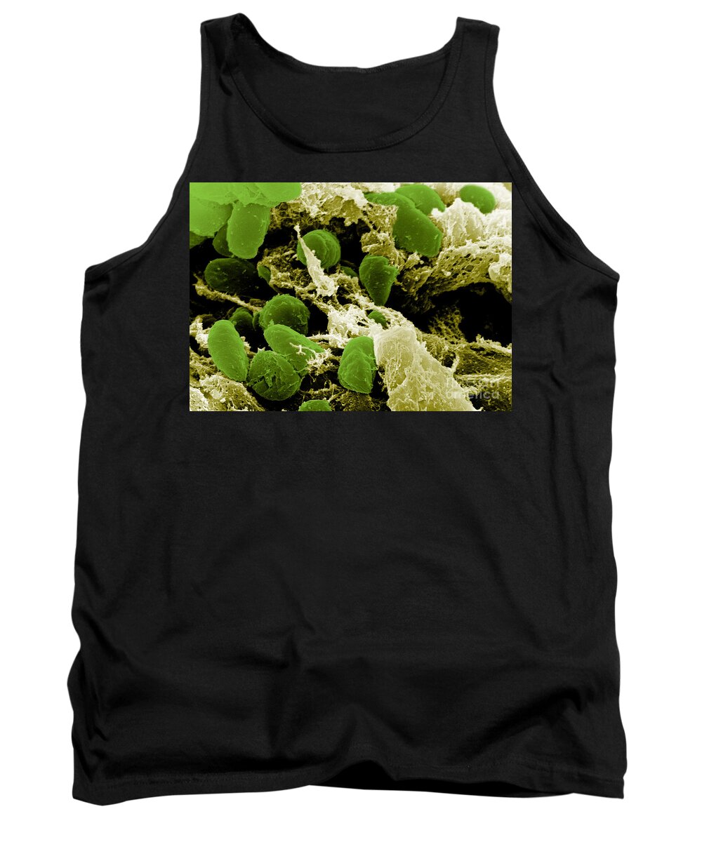 Microbiology Tank Top featuring the photograph Yersinia Pestis Bacteria, Sem #7 by Science Source