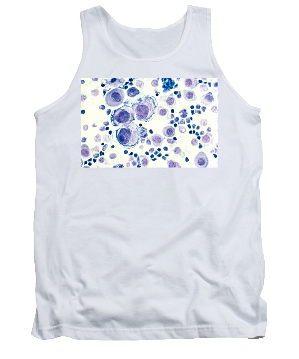 Metastatic Tank Top featuring the photograph Breast Cancer #1 by Science Source