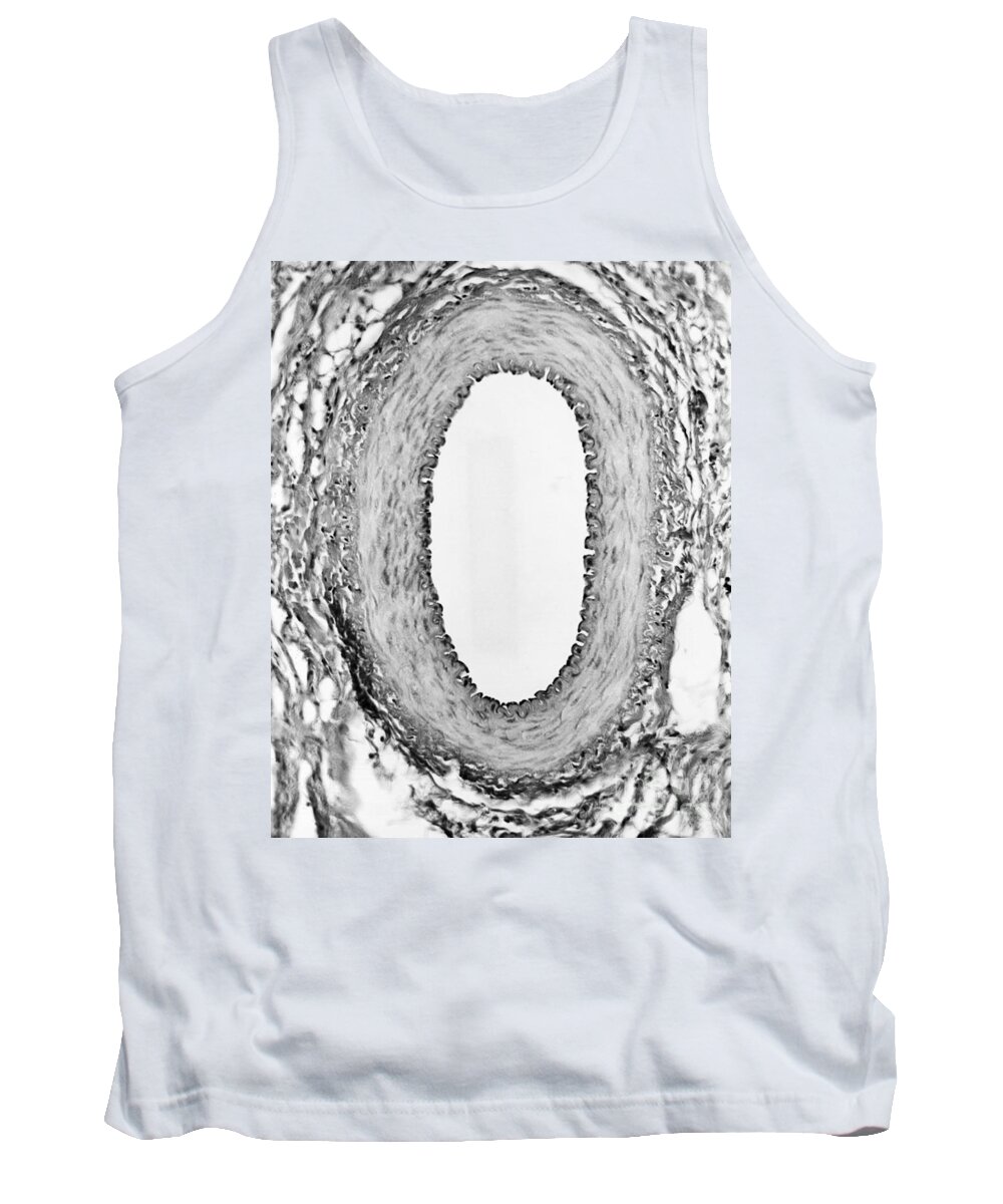 Science Tank Top featuring the photograph Normal Artery, Tem by Omikron