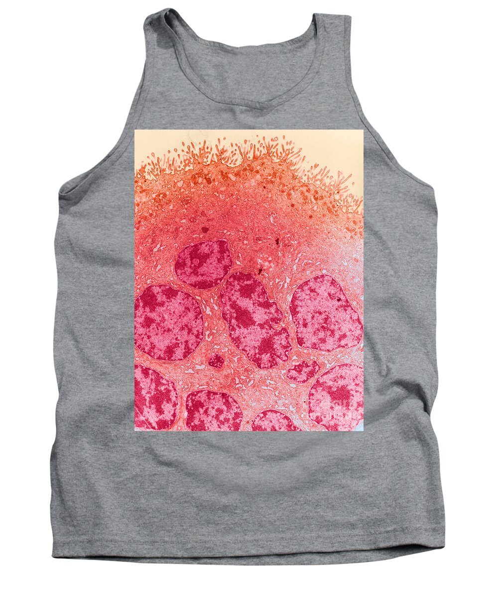 Histology Tank Top featuring the photograph Tem Of Placenta #1 by David M. Phillips