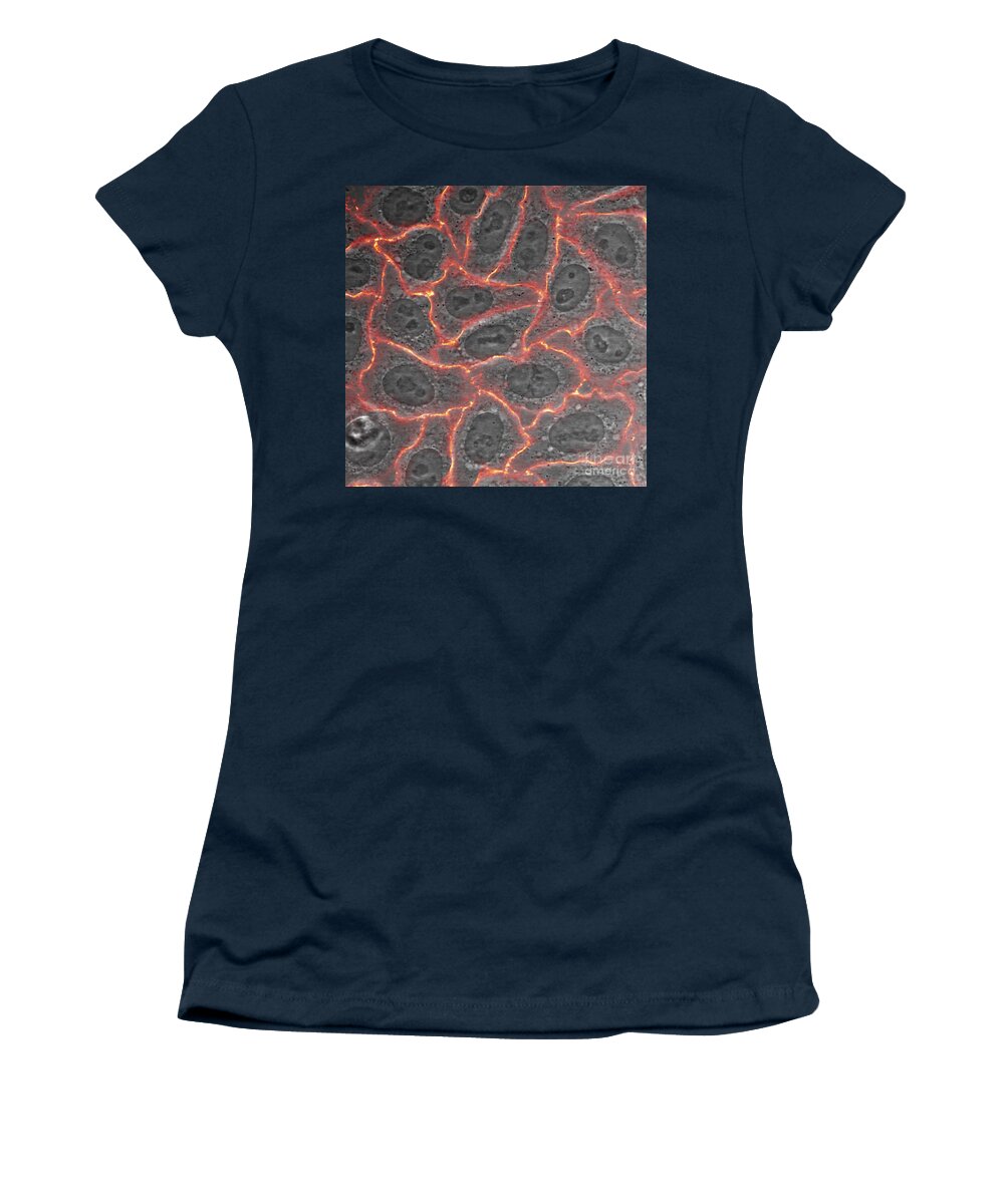 Tumoral Cell Women's T-Shirt featuring the photograph Nucleolin Confocal Micrograph by Voisin Phanie