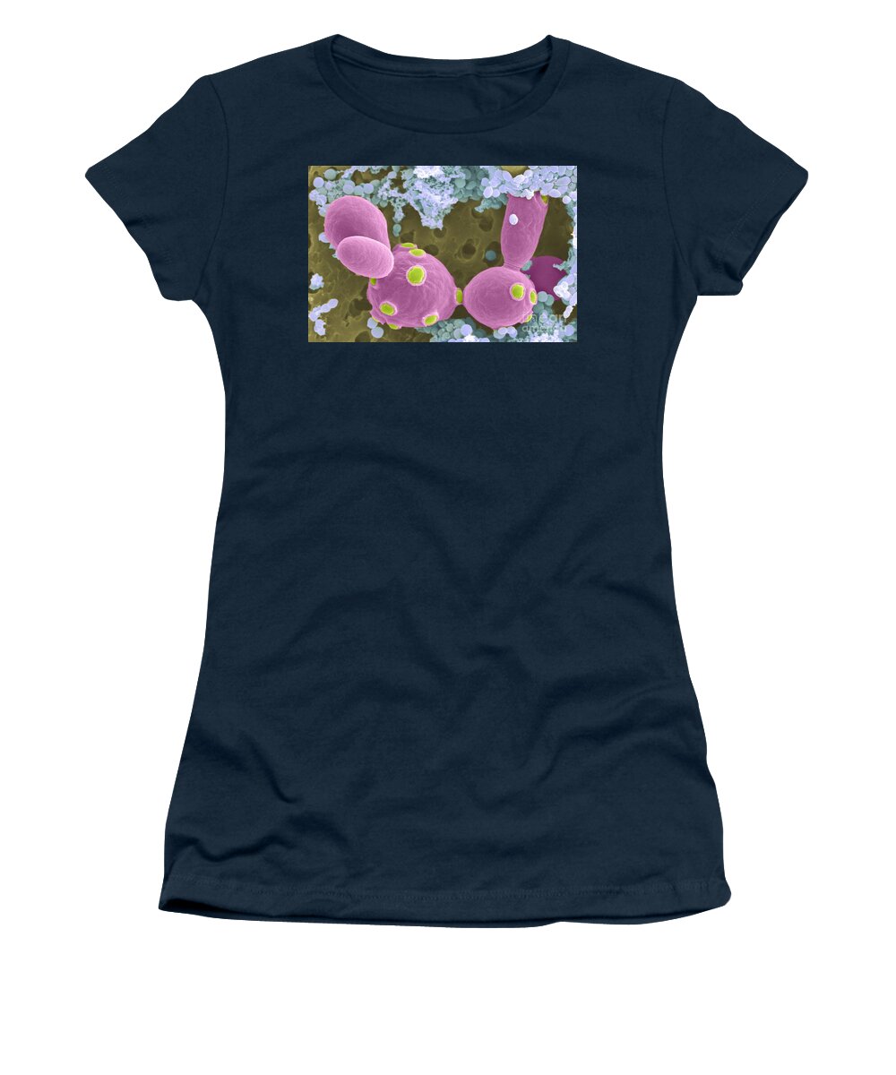 Saccharomyces Cerevisiae Women's T-Shirt featuring the photograph Saccharomyces Cerevisiae Sem #1 by Scimat