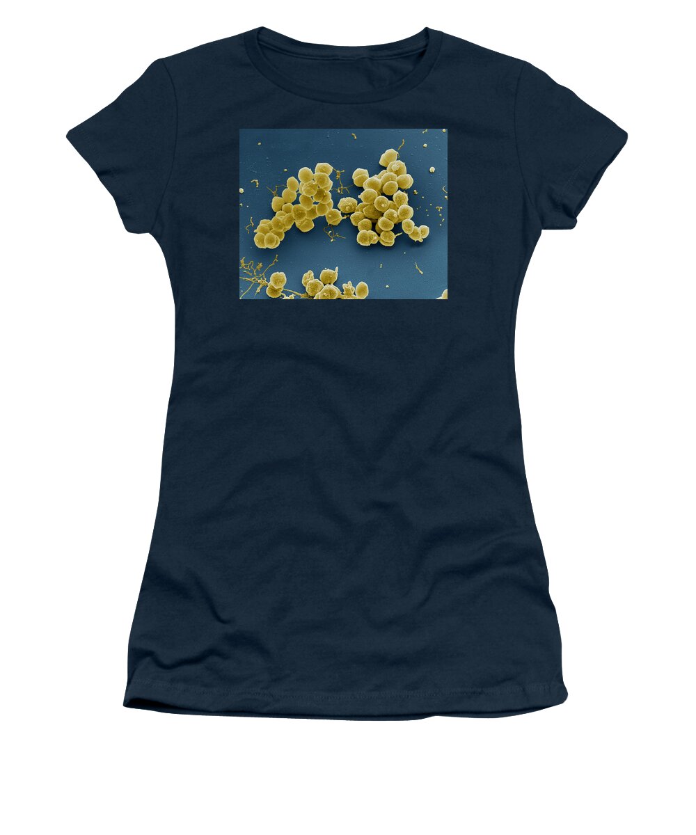 Bacteria Women's T-Shirt featuring the photograph Neisseria Meningitidis Sem by Meckes/ottawa