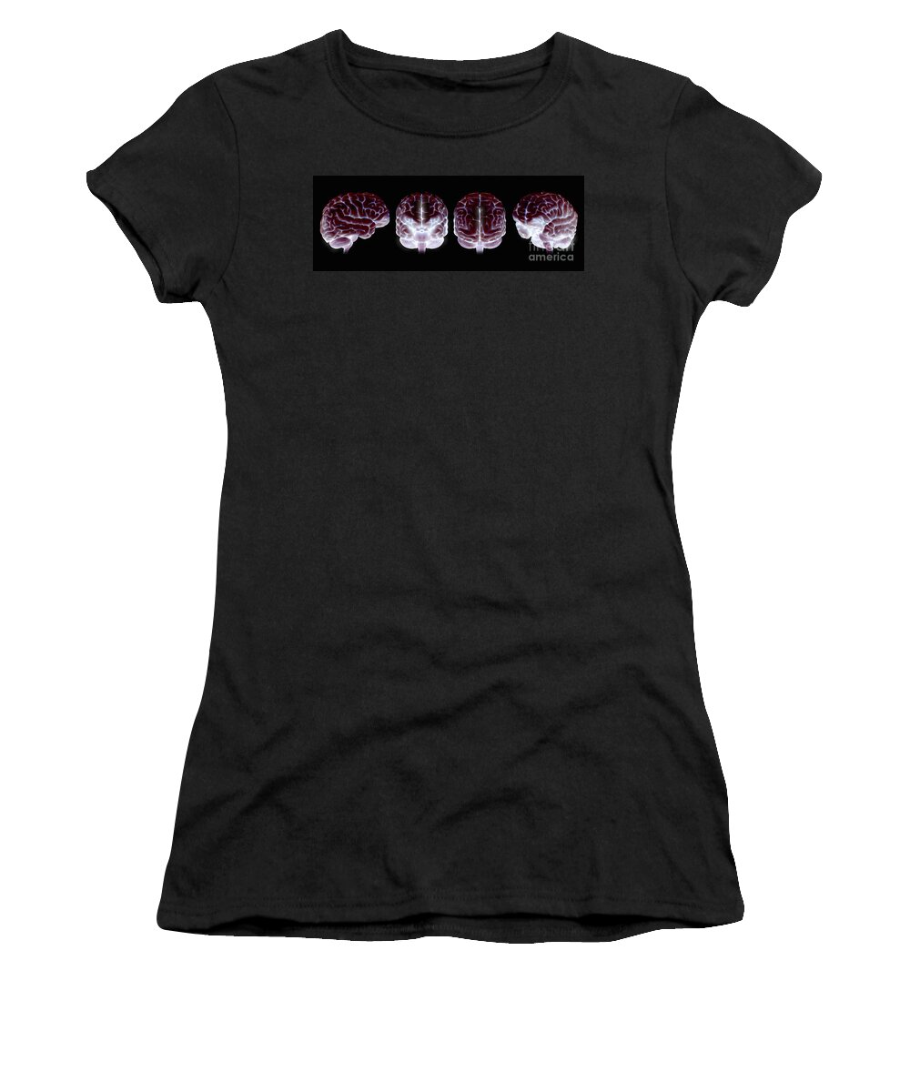 Temporal Lobe Women's T-Shirt featuring the photograph The Human Brain #6 by Science Picture Co