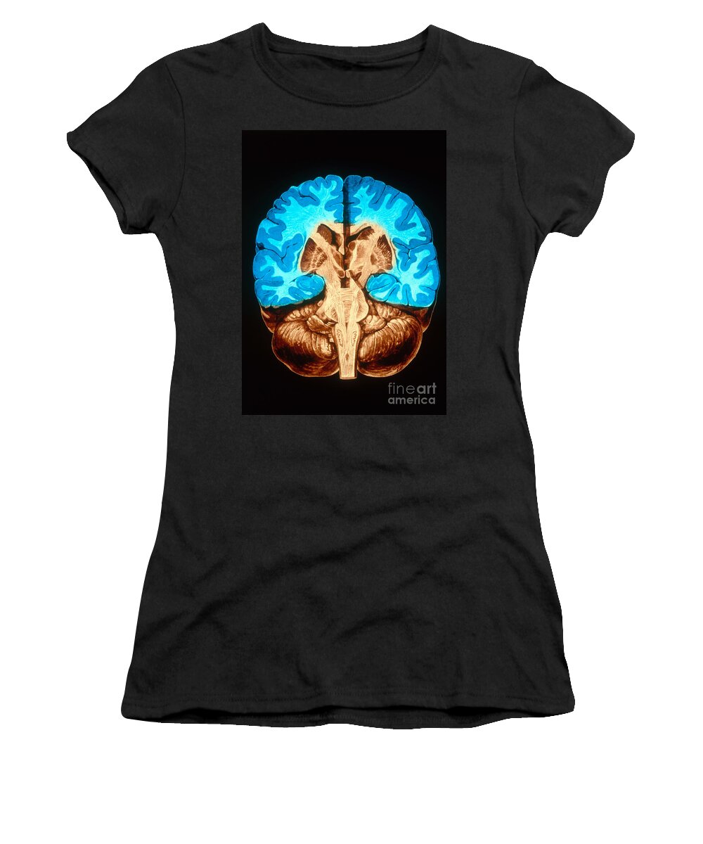 Brain Women's T-Shirt featuring the photograph Brain, Coronal Section by Scott Camazine