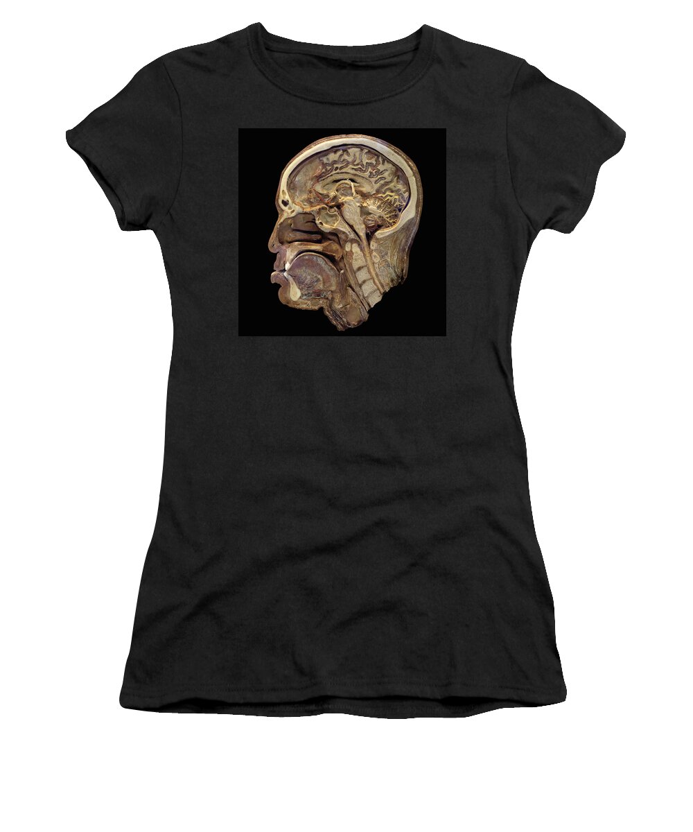 Science Women's T-Shirt featuring the photograph Human Head In Sagittal Section by Science Stock Photography