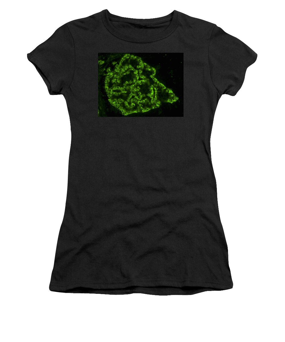 Micrograph Women's T-Shirt featuring the photograph Pancreatic Islet Stained For A Cells, Lm by Alvin Telser