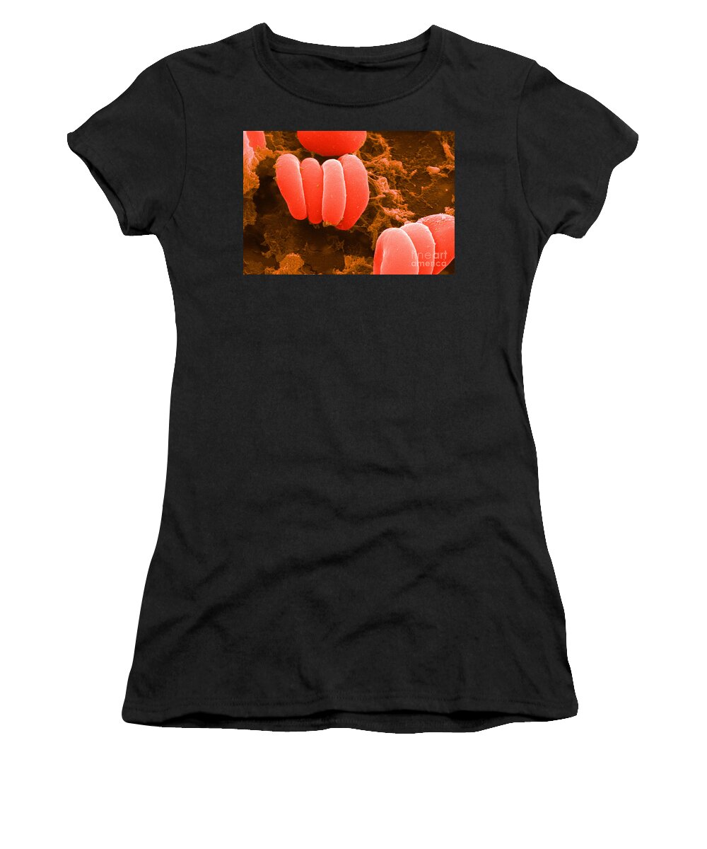 Biology Women's T-Shirt featuring the photograph Red Blood Cells, Rouleaux Formation, Sem by Science Source