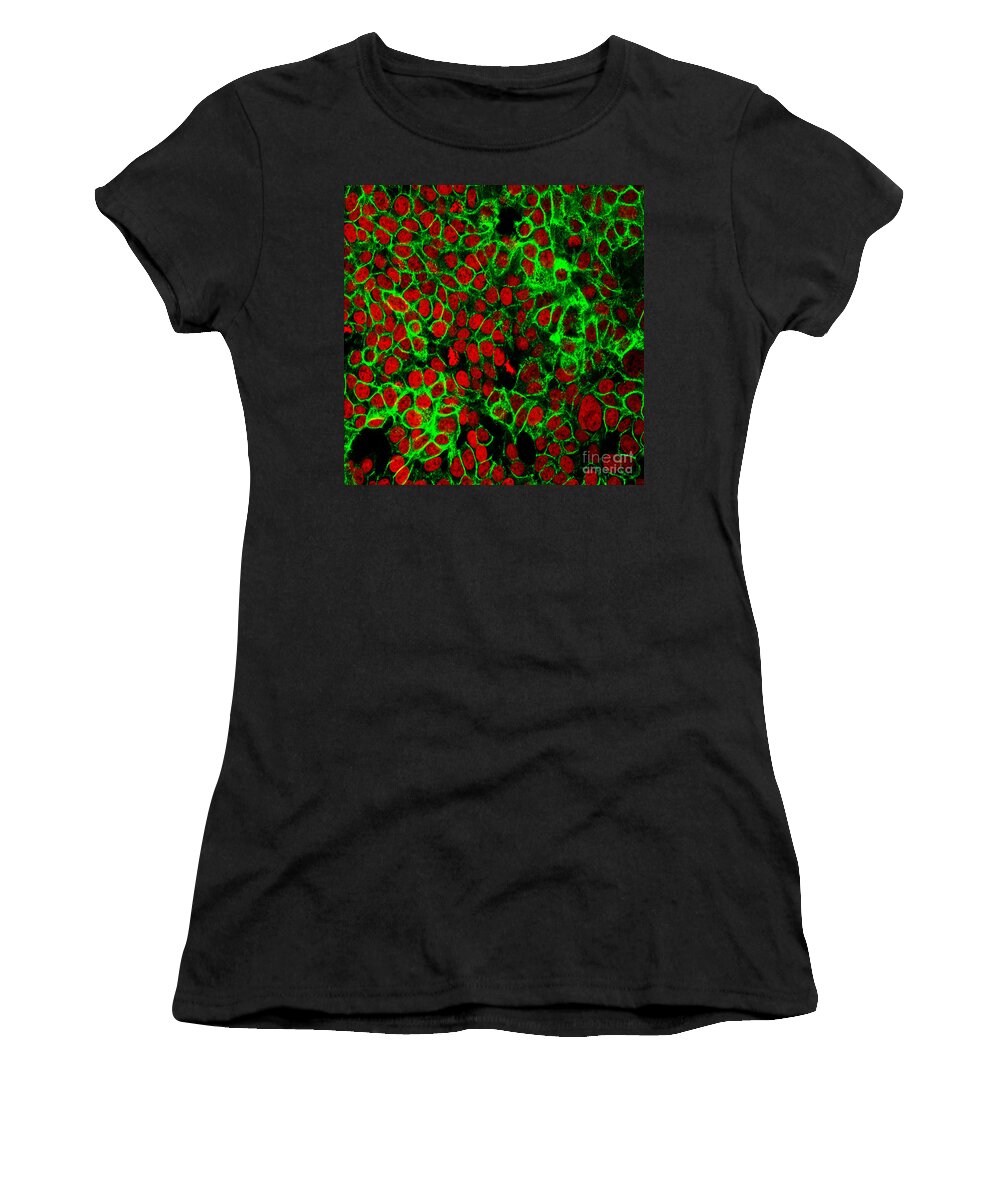 Science Women's T-Shirt featuring the photograph Colon Cancer Cells, Fm by Science Source
