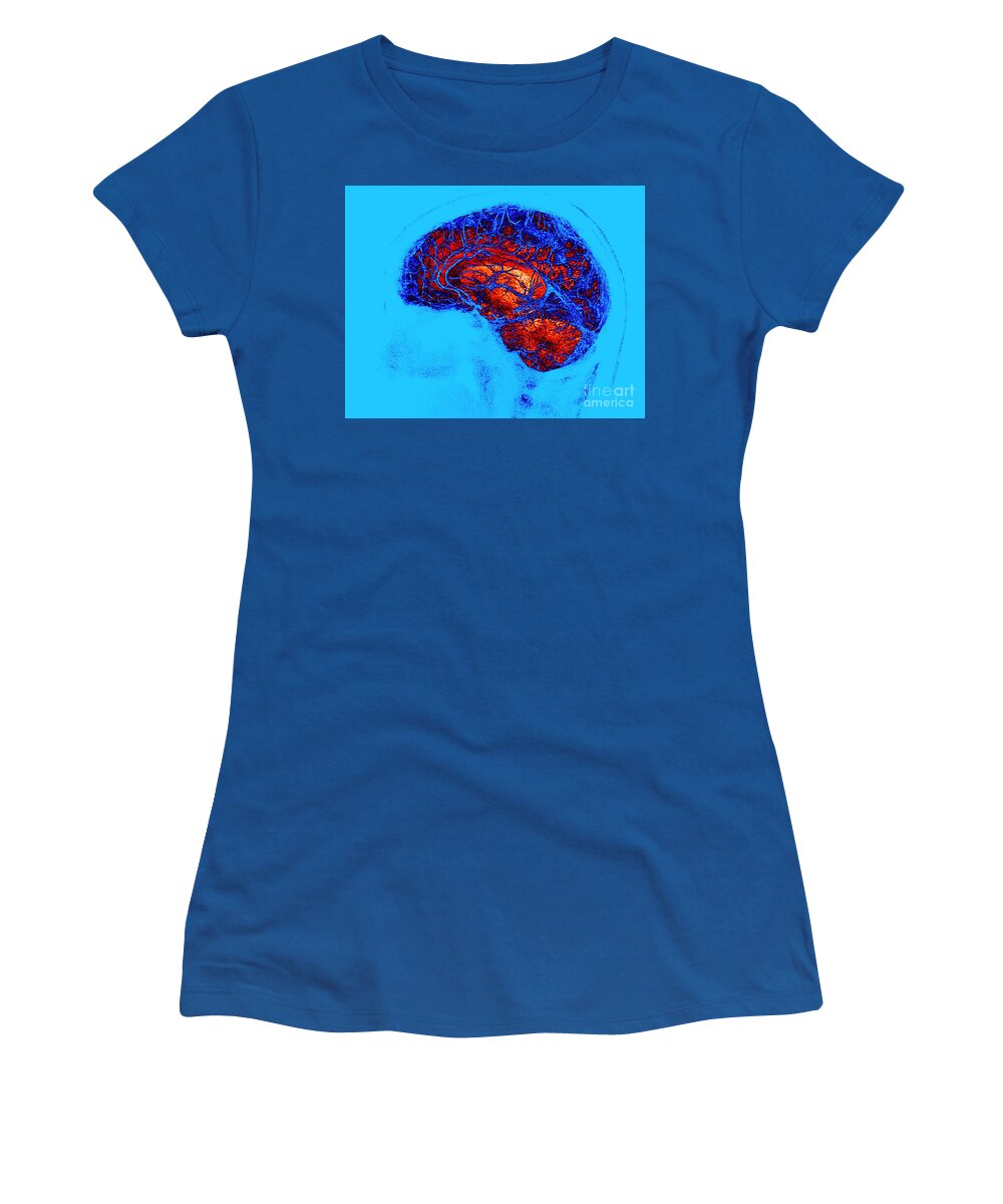 Brain Mri Women's T-Shirt featuring the photograph Normal Brain, Swi Mri by Living Art Enterprises