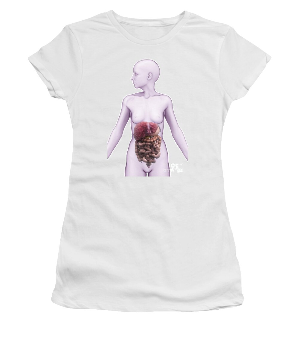 Abdomen Women's T-Shirt featuring the photograph Liver Cirrhosis #3 by Science Picture Co