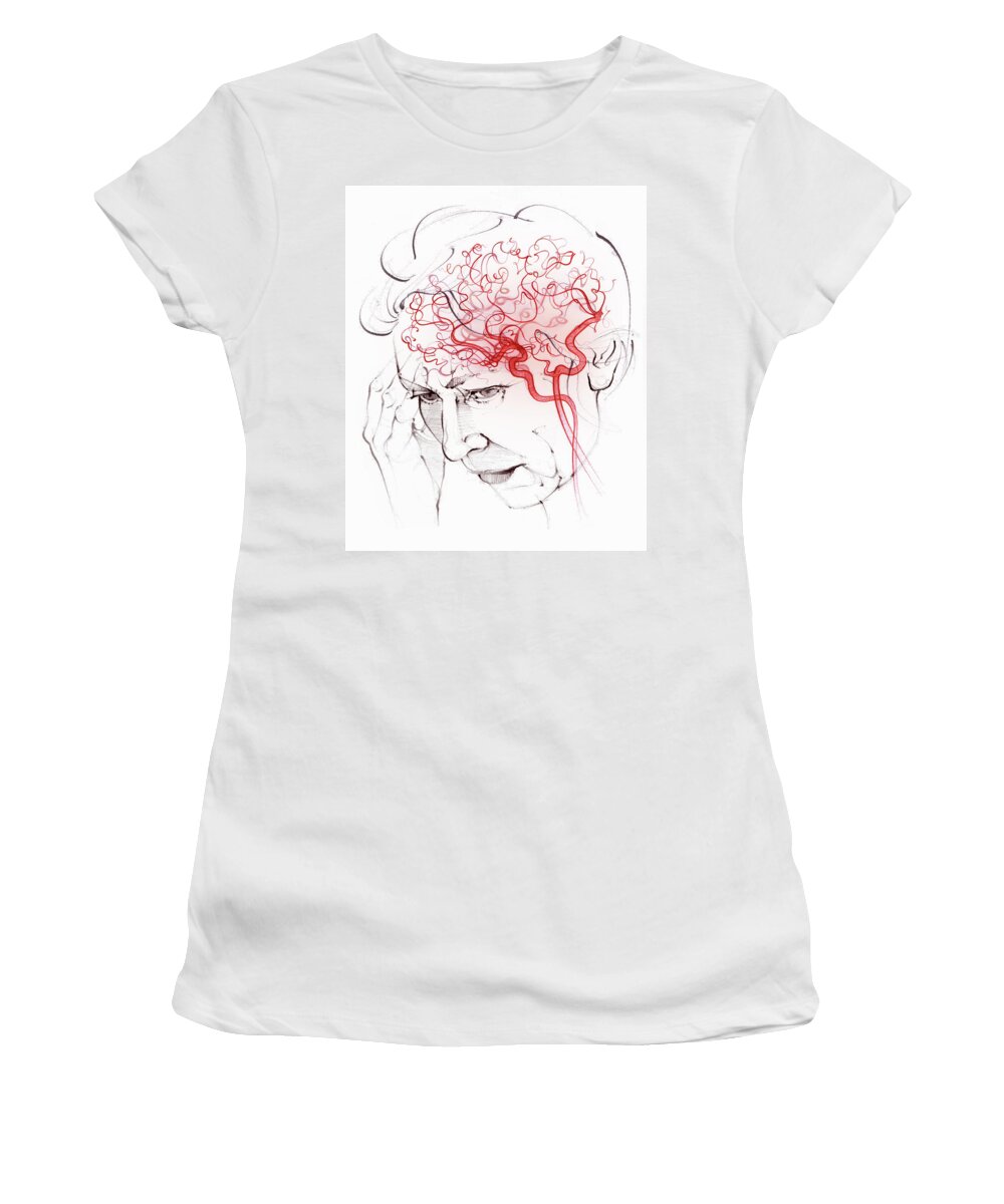 70-79 Years Women's T-Shirt featuring the photograph Brain Blood Supply In Elderly Woman by Ikon Ikon Images