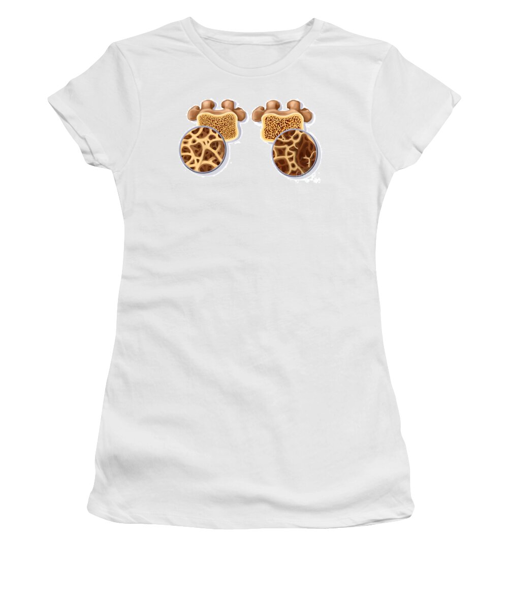 Abnormal Women's T-Shirt featuring the photograph Osteoporosis by Spencer Sutton