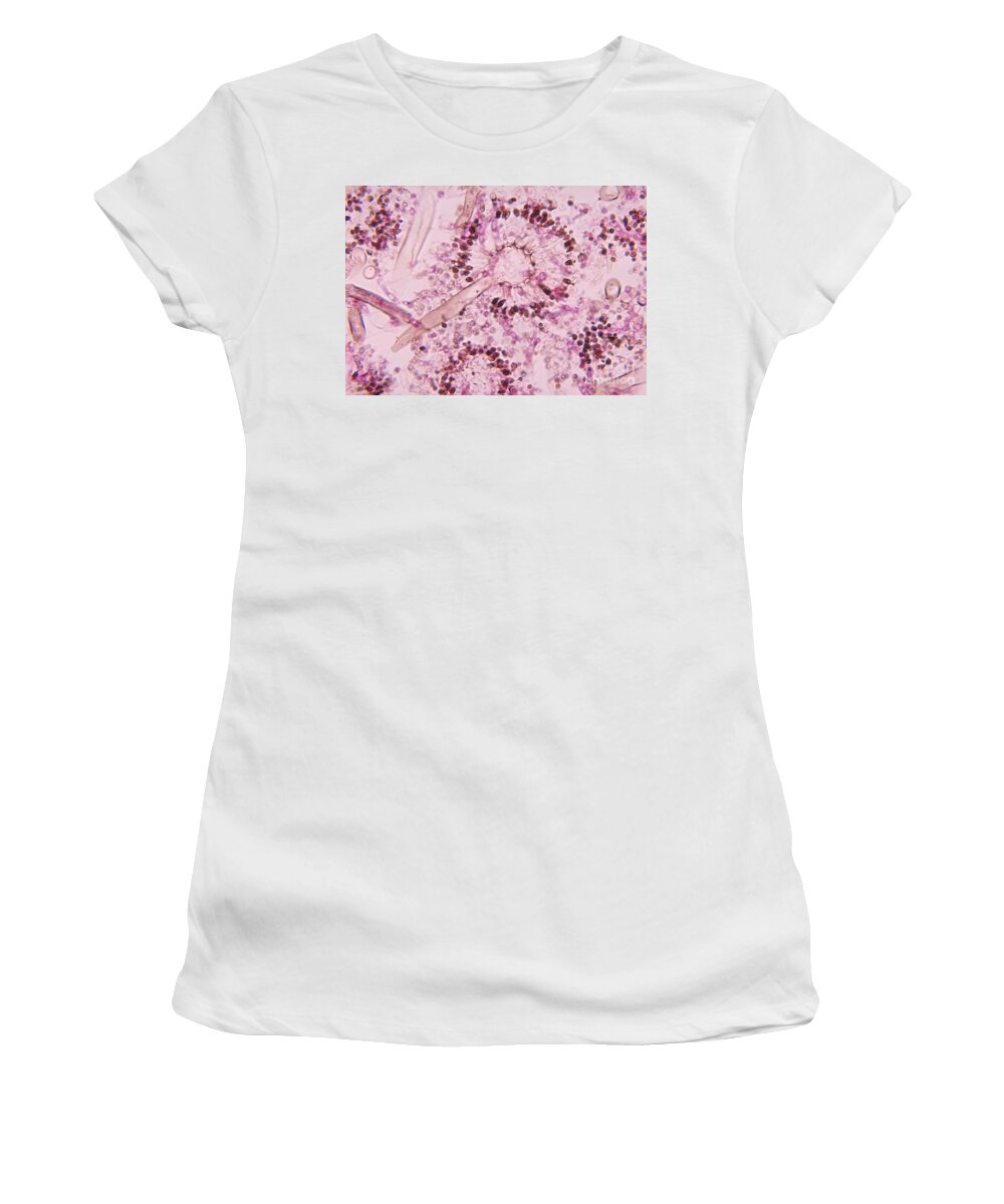Micrograph Women's T-Shirt featuring the photograph Aspergillus Niger #1 by Science Source