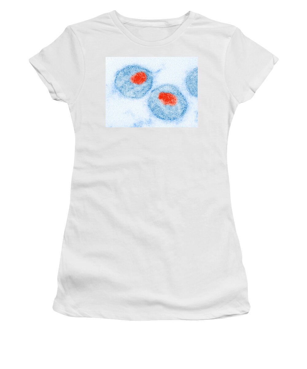 Aids Women's T-Shirt featuring the photograph Hiv #2 by Science Source