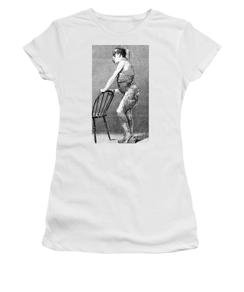 Science Women's T-Shirt featuring the photograph Joseph Merrick, The Elephant Man #3 by Science Source