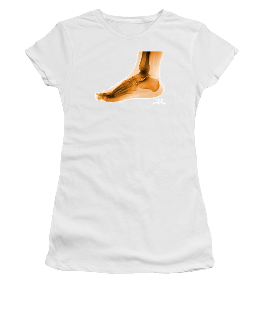 Anatomy Women's T-Shirt featuring the photograph Foot #2 by Medical Body Scans